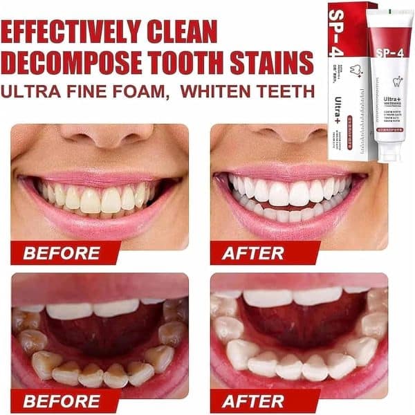 Yayashi Sp-4 Ultra Whitening Toothpaste Probiotic Stain Remover / Stain Removing Toothpaste, Protects Gums Freshens Breath, For Everyone - Image 2
